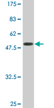 SERPINC1 monoclonal antibody (M02A), clone 2B12
