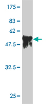 SERPINC1 monoclonal antibody (M02), clone 2B12