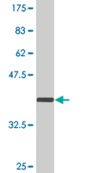 ASPH monoclonal antibody (M09), clone 3G5