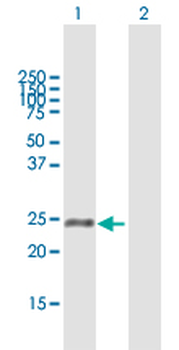 ASPH MaxPab rabbit polyclonal antibody (D03)
