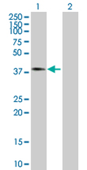 ASPH purified MaxPab mouse polyclonal antibody (B01P)