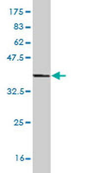 ASPA monoclonal antibody (M09), clone 3C11