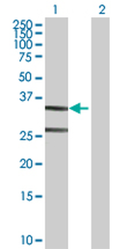 ASPA purified MaxPab rabbit polyclonal antibody (D01P)