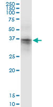 ASPA MaxPab rabbit polyclonal antibody (D01)