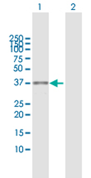 ASPA MaxPab rabbit polyclonal antibody (D01)