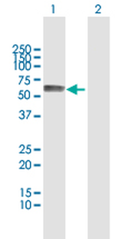 ASNS MaxPab rabbit polyclonal antibody (D01)