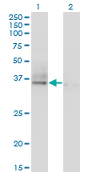 ASGR2 monoclonal antibody (M05), clone 1D7