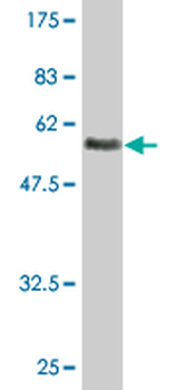 ASGR2 monoclonal antibody (M05), clone 1D7