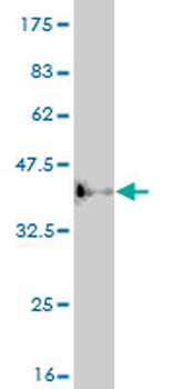 ASCL1 monoclonal antibody (M04), clone 1C5
