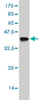 ASCL1 monoclonal antibody (M03), clone 3D3