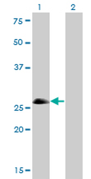 ASCL1 monoclonal antibody (M01), clone 7E11