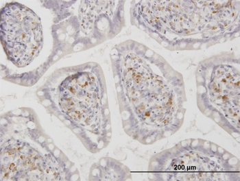 ASAH1 monoclonal antibody (M02), clone 1A7
