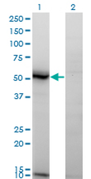 ASAH1 monoclonal antibody (M02), clone 1A7