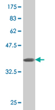 ASAH1 monoclonal antibody (M02), clone 1A7