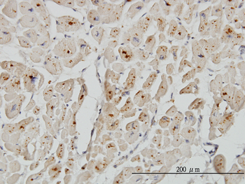 ASAH1 monoclonal antibody (M01), clone 2C9