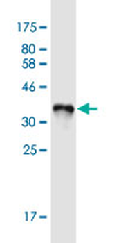 ART4 monoclonal antibody (M01), clone 2F8