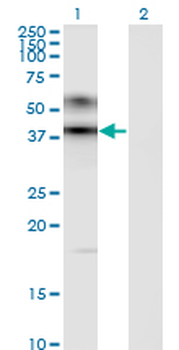 ART3 monoclonal antibody (M09), clone 1D2