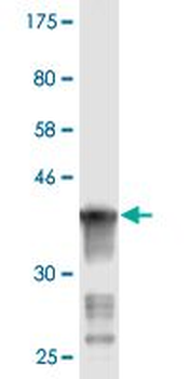 ART3 monoclonal antibody (M09), clone 1D2