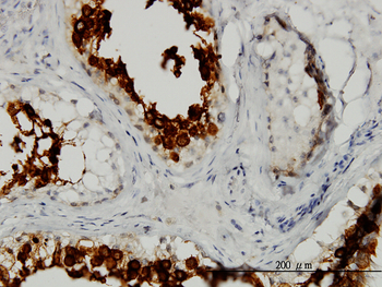 ART3 monoclonal antibody (M05), clone 3A2