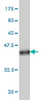 ART3 monoclonal antibody (M05), clone 3A2