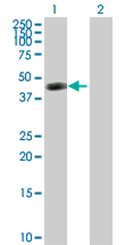 ART3 purified MaxPab rabbit polyclonal antibody (D01P)