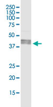 ART3 MaxPab rabbit polyclonal antibody (D01)