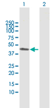 ART3 MaxPab rabbit polyclonal antibody (D01)