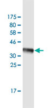ARSB monoclonal antibody (M10), clone 2G6
