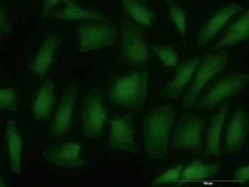 ARRB2 monoclonal antibody (M06J), clone 4D2