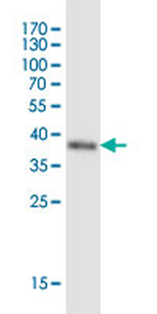 ARRB2 monoclonal antibody (M06J), clone 4D2