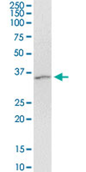 ARRB2 monoclonal antibody (M06), clone 4D2