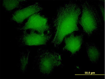 ARRB2 monoclonal antibody (M06), clone 4D2