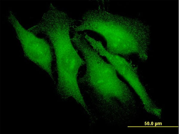 ARRB2 monoclonal antibody (M01), clone 3G1