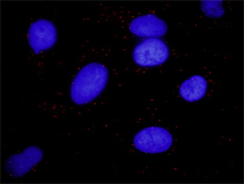 ARRB2 monoclonal antibody (M01), clone 3G1