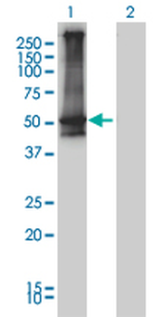 ARRB2 monoclonal antibody (M01), clone 3G1