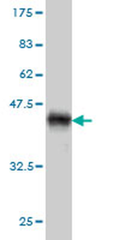 ARRB2 monoclonal antibody (M01), clone 3G1