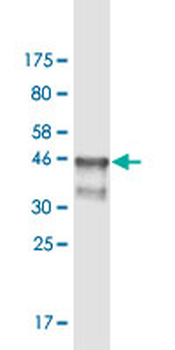 ARNT monoclonal antibody (M02), clone 1F12