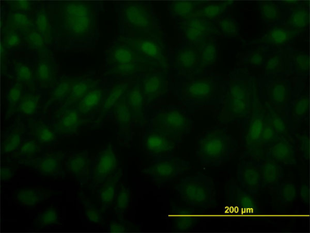 ARNT monoclonal antibody (M01), clone 3D10