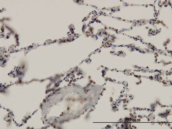ARNT monoclonal antibody (M01), clone 3D10