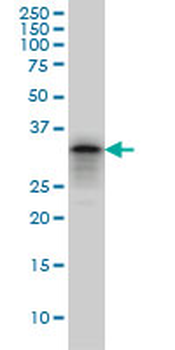 PHOX2A monoclonal antibody (M01), clone 4F6