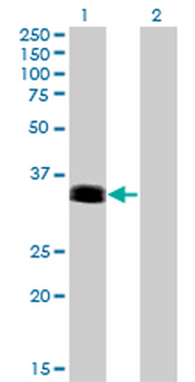 PHOX2A monoclonal antibody (M01), clone 4F6