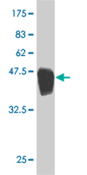ARHGDIG monoclonal antibody (M01), clone 1D11