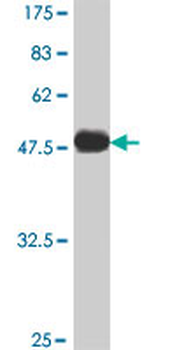 ARHGDIG polyclonal antibody (A01)