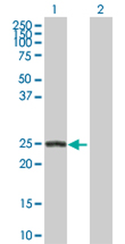 ARHGDIB purified MaxPab rabbit polyclonal antibody (D01P)