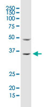 ARHGDIA monoclonal antibody (M02), clone 1G5-2F3