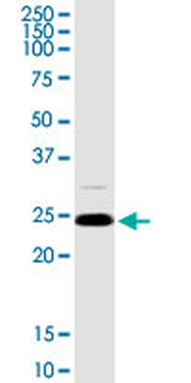 ARHGDIA purified MaxPab rabbit polyclonal antibody (D03P)