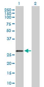 ARHGDIA purified MaxPab rabbit polyclonal antibody (D03P)