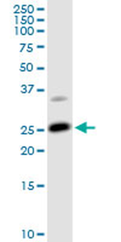 ARHGDIA purified MaxPab rabbit polyclonal antibody (D01P)