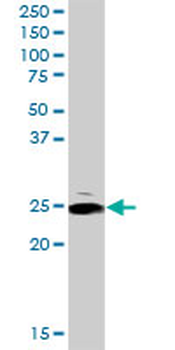 ARHGDIA purified MaxPab rabbit polyclonal antibody (D01P)