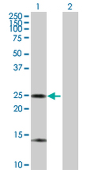 ARHGDIA purified MaxPab rabbit polyclonal antibody (D01P)